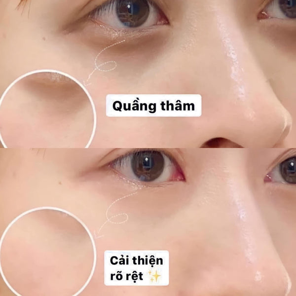 [Cha Skin] Snail Wrinkle Care Eye Cream 40ml