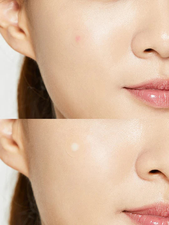 [COSRX] Akne Pimple Master Patch 24 plastre
